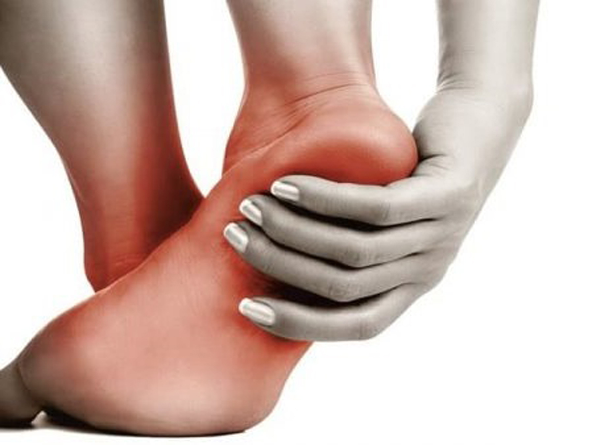 Лечение пяточной шпоры в Израиле: эффективность ударно-волновой терапии